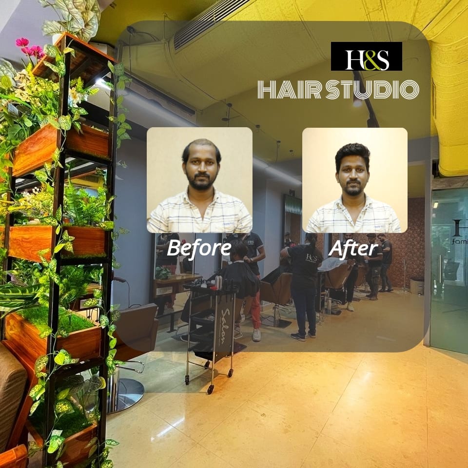 professional Hair Fixing in chennai