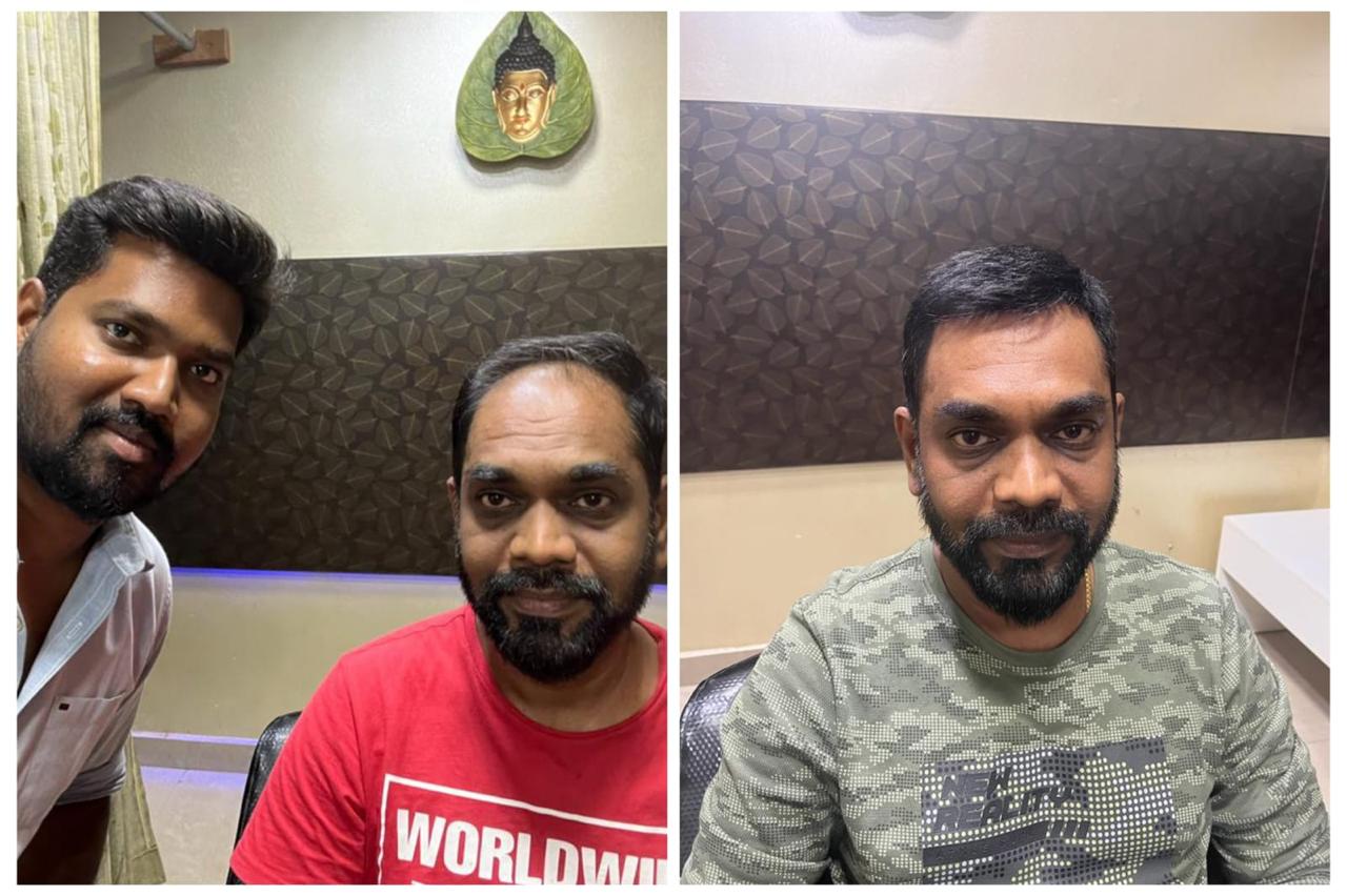 Hair Fixing in chennai