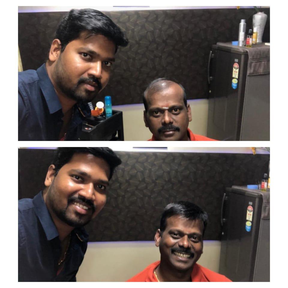 Hair Fixing in chennai
