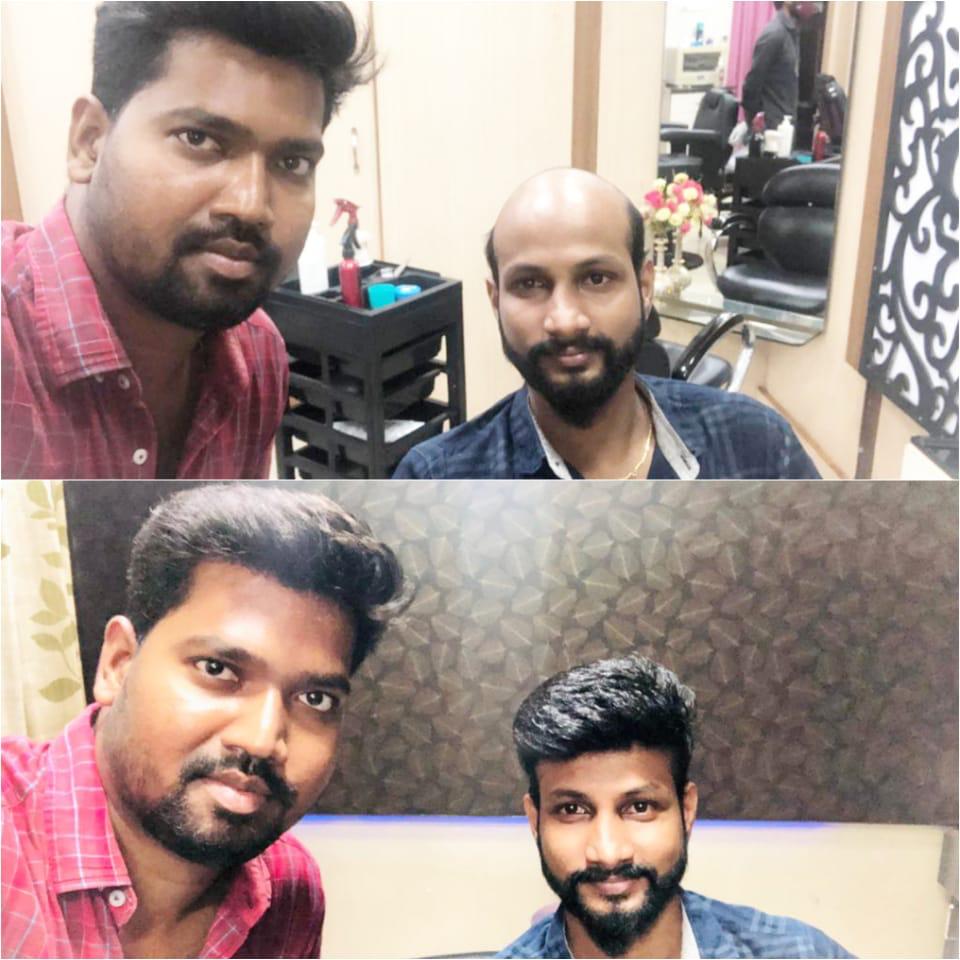 professional Hair Fixing in chennai