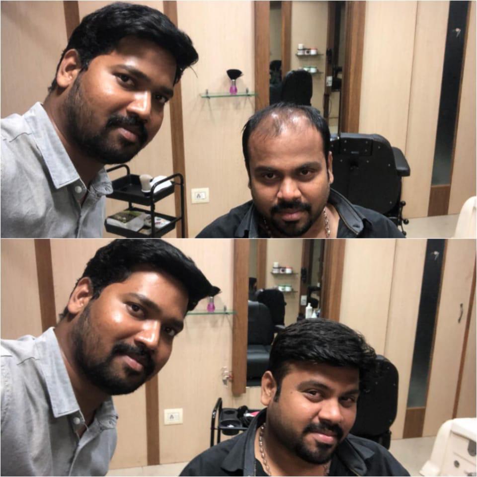 professional Hair Fixing in chennai