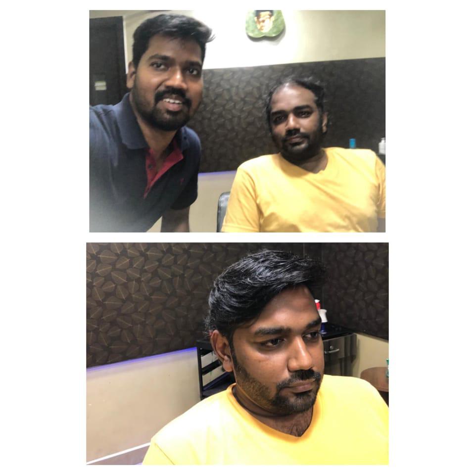 professional Hair Fixing in chennai