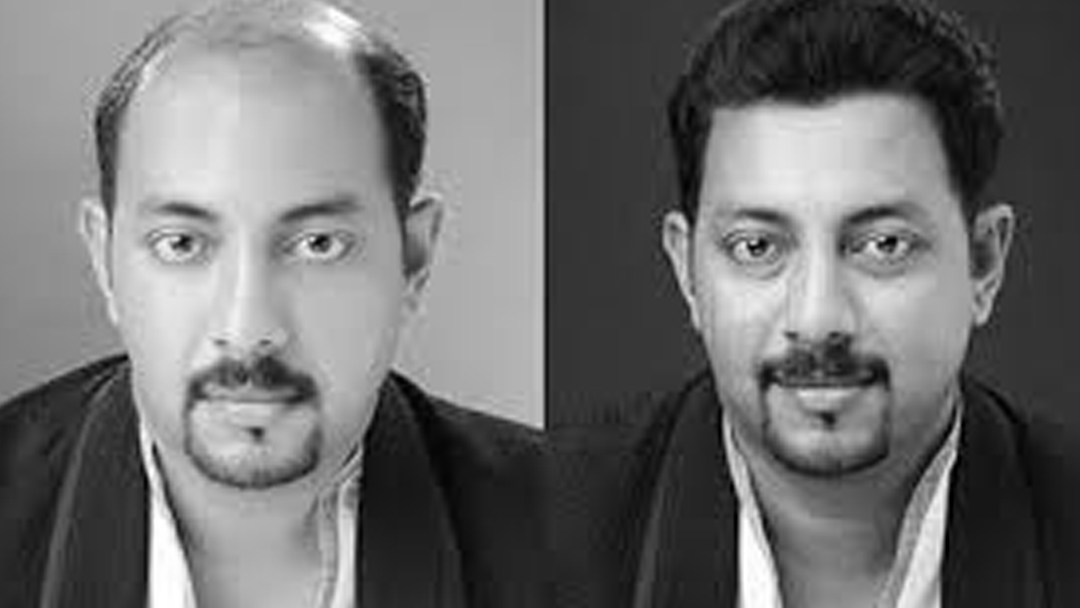 Facial expert in chennai